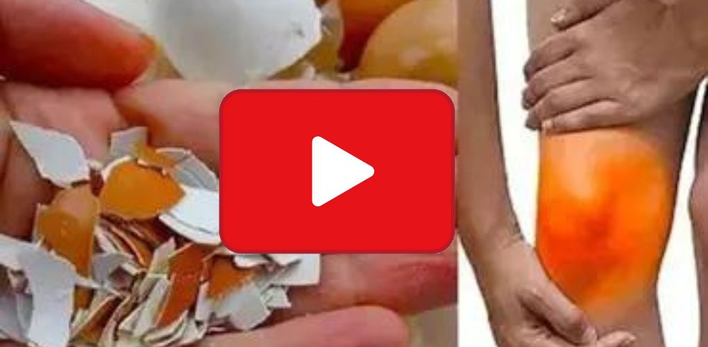 video of natural way to relieve foot pain